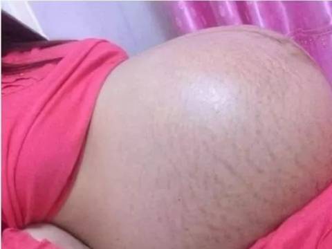 95后孕妈怀胎八月,每天烧烤啤酒为伴,孩子出生后医生连退三步