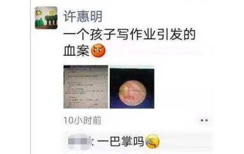 爸爸一巴掌,儿子耳膜穿孔:放学后千万别催孩子写作业,这样做比催100次管用