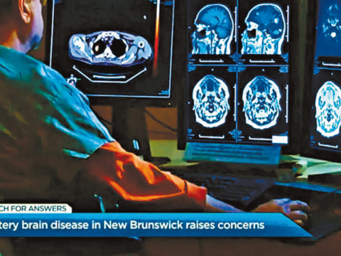 加拿大年輕族群 神秘腦部怪病或傳染 個案超150例 吹哨者急示警