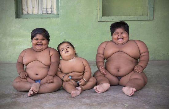 印度三姐弟成世界最胖幼儿 父亲欲卖肾为其治疗