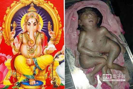 印度四手四脚畸形婴儿 被指神明转世 受跪拜