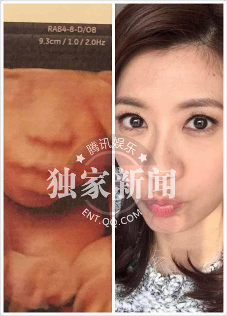 贾静雯肚中爱女4D彩超照曝光 与妈妈“神撞脸”