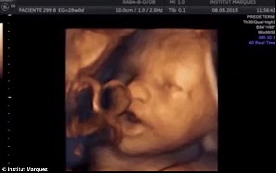 胎儿听到音乐后 竟似乎在子宫里唱歌(组图/视频)