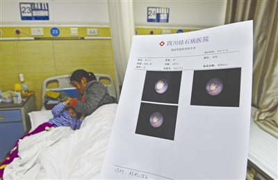 四川2岁男童膀胱长结石 医生:天天吃辣条所致
