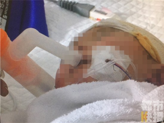 陕西商洛2岁男童玩耍出意外 钢筋插进头部