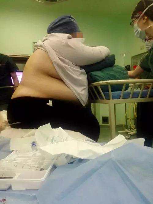 260斤妊妇产子 女婴刚身世就被请求一辈子节食