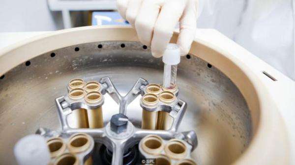尸体取精：男性逝世亡48小时后精子仍能孕育宝宝