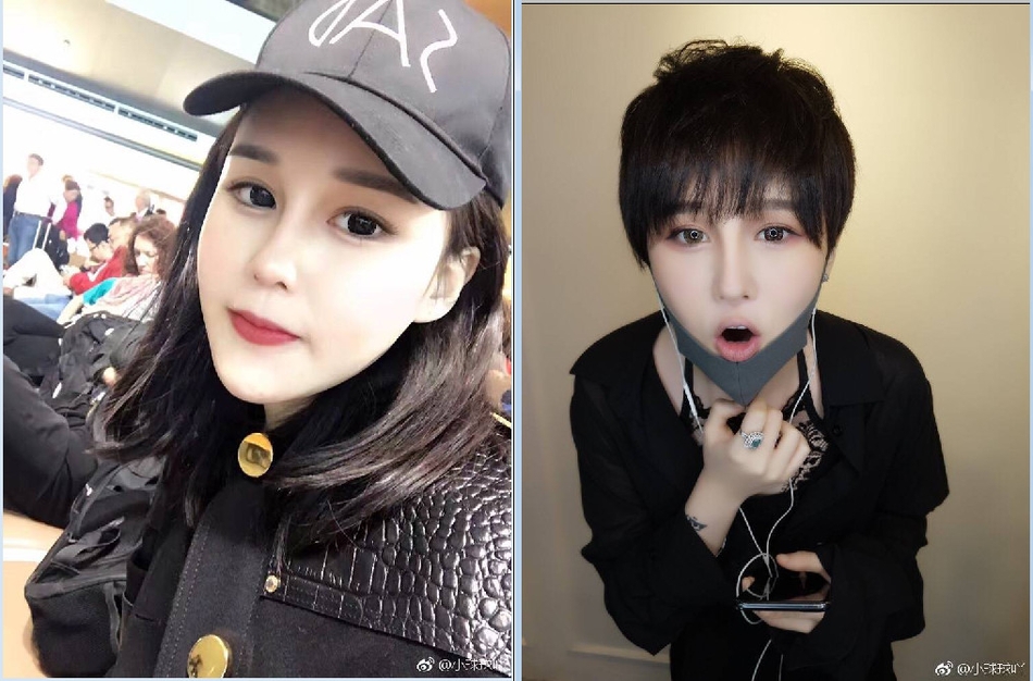 赵本山女儿球球直播认可整容:看我爹就知道