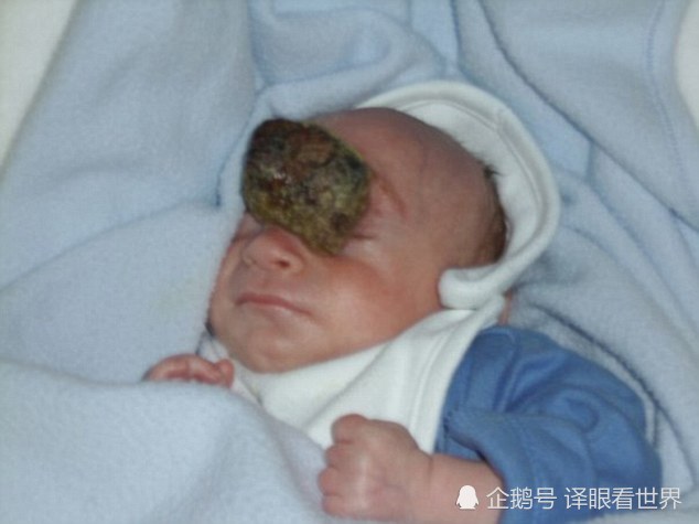 男孩生成大脑在体外 医生弃疗 妈妈把他养到10岁