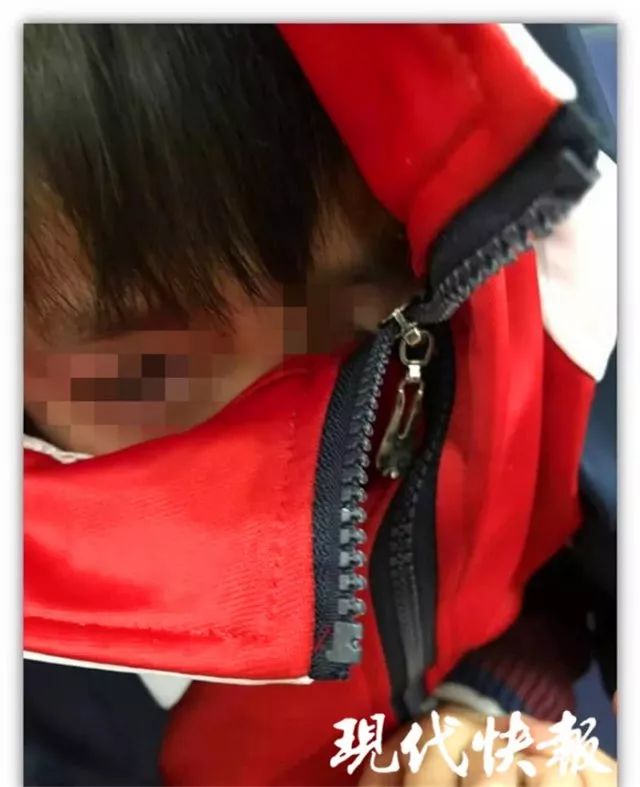 眼皮被拉链锁住 医生都没辙!6种衣服少给孩子穿
